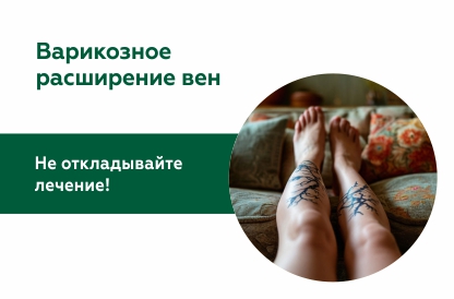Жизнь с варикозом и без. Почему пациенты не начинают лечение?
